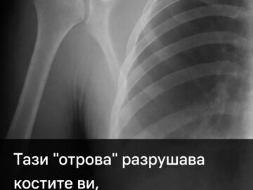 Тази „отрова“ разрушава костите ви, но я пиете всеки ден