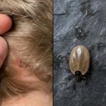 Някой знае ли какво е това насекомо? Току-що го открих в косата на сина ми…