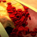 Ето кой плод сваля кръвното и холестерола без никакъв проблем