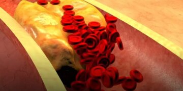 Ето кой плод сваля кръвното и холестерола без никакъв проблем